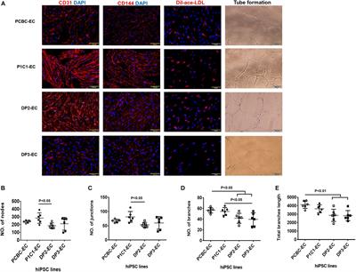 Diabetic Endothelial Cells Differentiated From Patient iPSCs Show Dysregulated Glycine Homeostasis and Senescence Associated Phenotypes